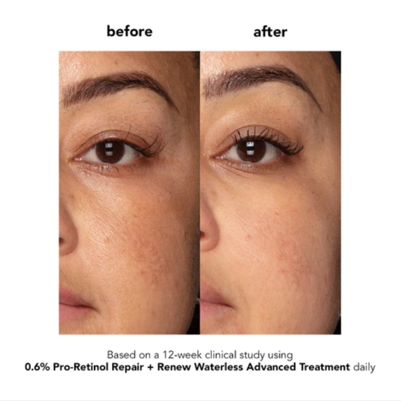 Set of 2: Boscia 0.6% Pro-Retinol Repair + Renew Waterless Advanced Trea… - Picture 3 of 5